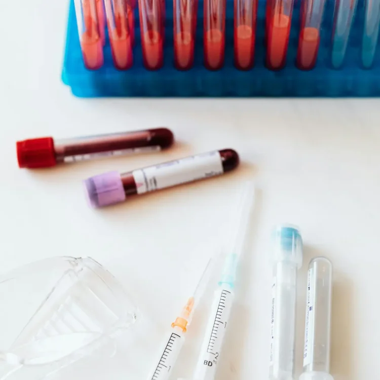 Labs & Lab Review